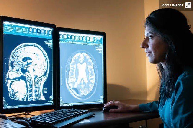 Ultrasound triggers brain's waste disposal system in Alzheimer's patients
